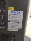 УЗИ аппарат Chison i6 с датчиками