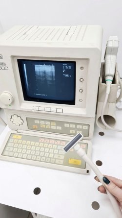Аппарат ультразвуковой диагностики Aloka SSD-500