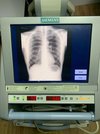 Цифровой палатный рентгенаппарат Siemens modilett XP Digital