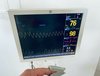 Монитор пациента DATEX Carescape B850 на стойке