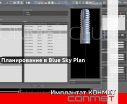 Планирование дентальной имплантации в программе Blue Sky Plan на имплантатах КОНМЕТ!