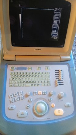 Узи аппарат Toshiba ssa 510a