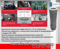 КОНМЕТ - российский производитель: дентальных имплантатов, ортодонтических имниимплантатов, изделий для челюстно-лицевой хирургии