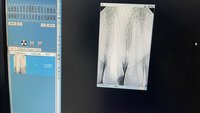 Рентген прицельный зубной Progeny preva в исправном состоянии без датчика