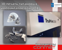 3D печать титановых имплантатов для ЧЛХ