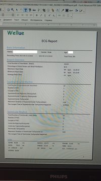 Холтер Монитор ЭКГ Wellue + AI-ECG Analysis System