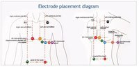 Холтер Монитор ЭКГ Wellue + AI-ECG Analysis System