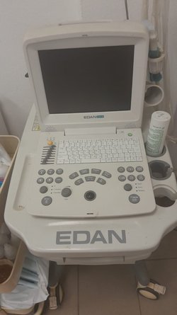 Портативный узи аппарат Edan dus 60