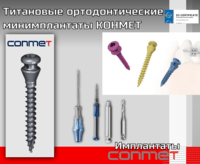 Титановые ортодонтические минимплантаты КОНМЕТ