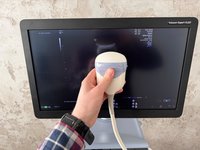 УЗИ аппарат GE Voluson E10