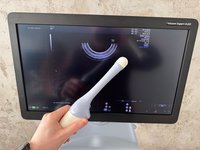 УЗИ аппарат GE Voluson E10