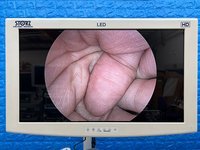 Блок управления видеокамерой Karl Storz IMAGE 1 HUB и Камерная головка Karl Storz IMAGE 1 H3-Z FULL HD