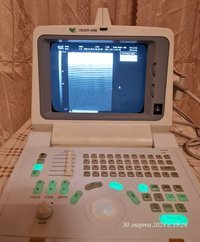 УЗ аппарат Чисон б/у