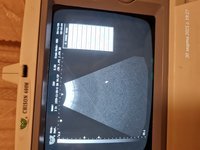 УЗ аппарат Чисон б/у