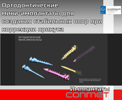 Ортодонтические мини-имплантаты для создания стабильных опор