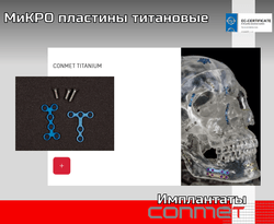МиКРО пластины титановые