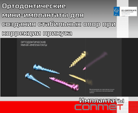 Ортодонтические мини-имплантаты для создания стабильных опор