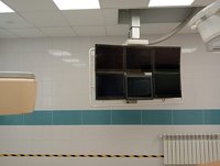 АНГИОГРАФ PHILIPS ALLURA XPER FD10