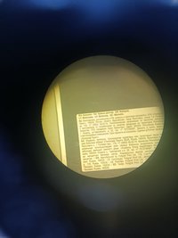 Видеокольпоскоп ЭКС-1М