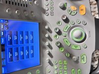 Узи аппарат Toshiba Aplio 500