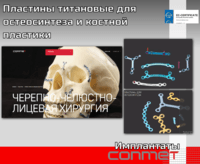 Пластины титановые для остеосинтеза и костной пластики Имплантационные системы