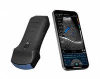 Портативный УЗИ аппарат 3 в 1