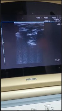 Узи-аппарат Toshiba SSA-510A