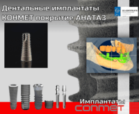 Дентальные имплантаты КОНМЕТ, особенности покрытия