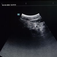 УЗИ сканер Mindray Consona N9 (демо) 2024 год выпуска