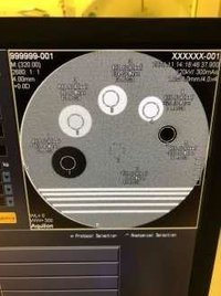 КТ Toshiba Aquilion 32