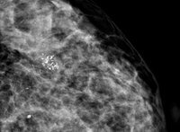 СИСТЕМА МАММОГРАФИЧЕСКАЯ «РЕНЕКС-МАММО» комплектация “ПРЕМИУМ+”