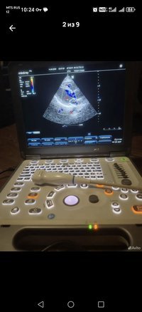 Портативный узи аппарат Міndrау М5 Premium