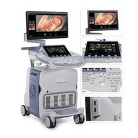 GE Voluson E8 BT16 (корпус E10)