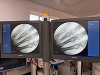 Philips BV-Pulsera 2018 года 15 кВт