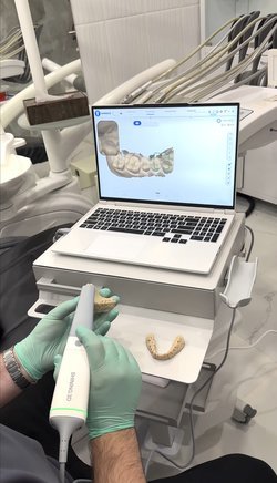 Интрооральный сканер Shining3D - аренда в Москве 