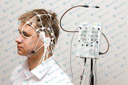 Энцефалограф Реограф МИЦАР, Эхоэнцефалодоплерограф ЭхЭДГ Комплекс-М 