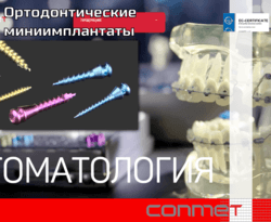 Винты ортодонтические