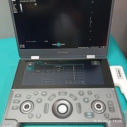 Узи сканер Mindray MX8 exp 2022г (Демо)