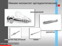 МИНИ-ИМПЛАНТАТЫ Ортодонтические для установки в области альвеолярного отростка В Наличии!