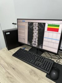 Денситометр рентгеновский Medikors InAlyzer AIR