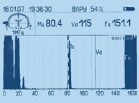 Синускоп  Sinuscan 103 Oriola, АНГИОДИН-Эхо/П-Лор,  эхоэнцефалограф PC-BRAIN