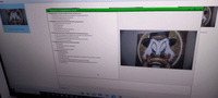 Видеокольпоскоп Kernel KN 2200