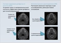 КЛКТ FinScan F350 16х10 