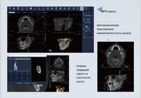 КЛКТ FinScan F350 16х10 