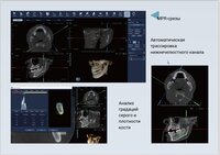 КЛКТ FinScan F350 16х10 