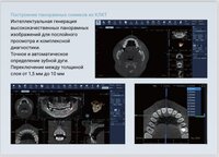КЛКТ FinScan F350 16х10 