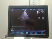 УЗИ аппарат GE Vivid S5 