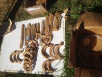 Аппарат Илизарова Комплект компрессионно-дистракционных аппаратов Илизарова для всего тела
