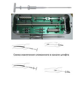 Универсальный экстрактор интрамедуллярных стержней