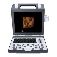 УЗИ-аппарат SIUI Apogee 1100